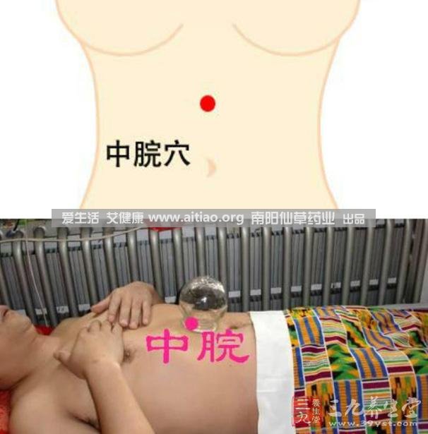 中脘穴位于腹部正中線，臍上4寸的位置上。每天艾灸10-15分鐘，能有效緩解胃部不適的癥狀，同時(shí)有助于祛濕。