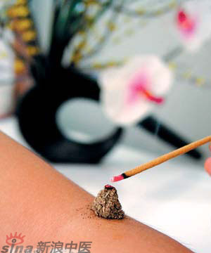 節(jié)氣灸” 冬至，你灸了嗎？